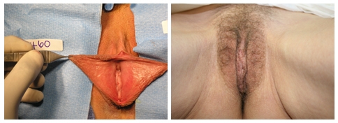 Vagina